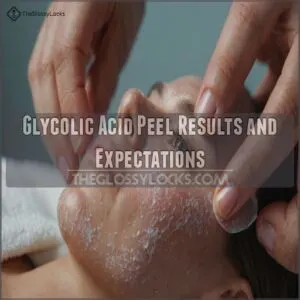 Glycolic Acid Peel Results and Expectations