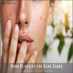 Home Remedies for Acne Scars