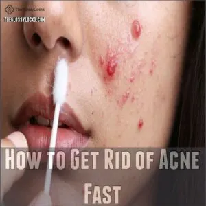 How to Get Rid of Acne Fast