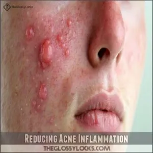 Reducing Acne Inflammation