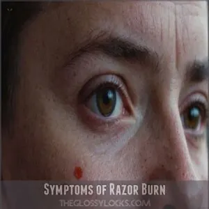 Symptoms of Razor Burn