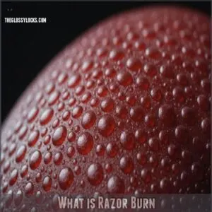 What is Razor Burn