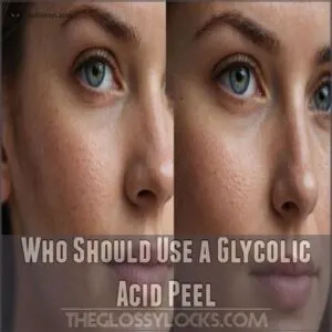 Who Should Use a Glycolic Acid Peel