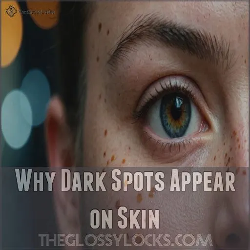 Why Dark Spots Appear on Skin