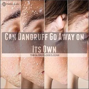 Can Dandruff Go Away on Its Own