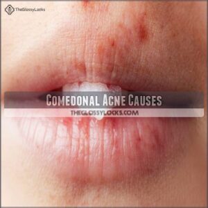 Comedonal Acne Causes