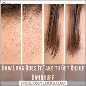 How Long Does It Take to Get Rid of Dandruff