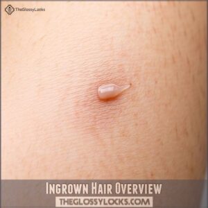 Ingrown Hair Overview