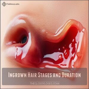 Ingrown Hair Stages and Duration