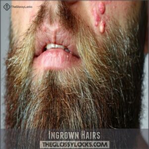 Ingrown Hairs