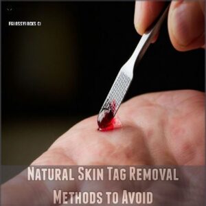 Natural Skin Tag Removal Methods to Avoid