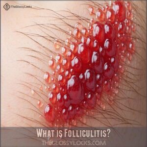 What is Folliculitis