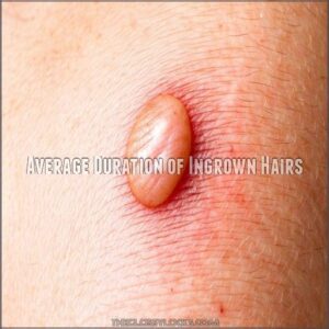 Average Duration of Ingrown Hairs