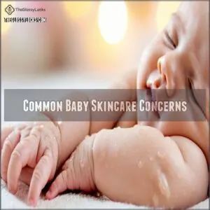 Common Baby Skincare Concerns