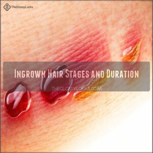 Ingrown Hair Stages and Duration