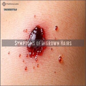 Symptoms of Ingrown Hairs