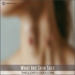 What Are Skin Tags