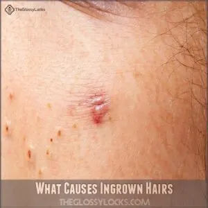 What Causes Ingrown Hairs