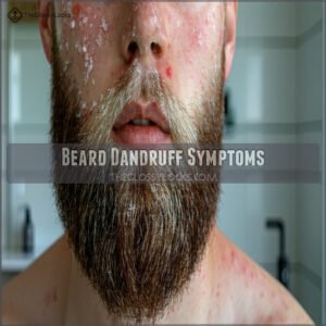 Beard Dandruff Symptoms