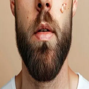 Early Beard Growth Challenges Early Beard Growth Challenges