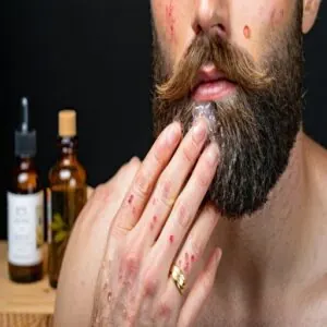 Exfoliation and Cleaning Routine Exfoliation and Cleaning Routine
