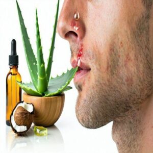 Home Remedies for Relief Home Remedies for Relief