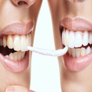 How to Floss Correctly: a Step-by-Step Guide