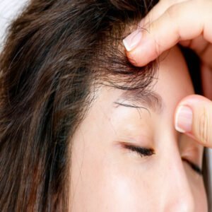 Preventing Scalp Sensitivity