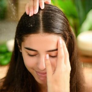 Scalp Care Basics