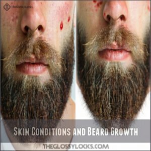 Skin Conditions and Beard Growth