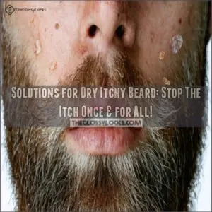 solutions for dry itchy beard