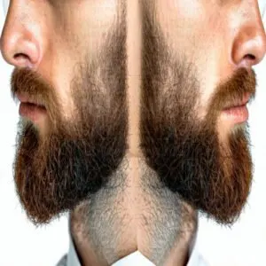 What Are Mutton Chops Beard Styles