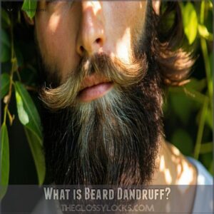 What is Beard Dandruff