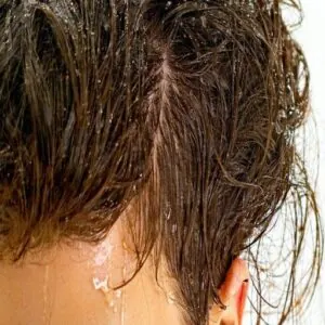 What is Oily Hair What is Oily Hair