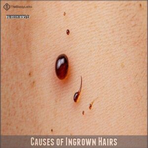 Causes of Ingrown Hairs Causes of Ingrown Hairs