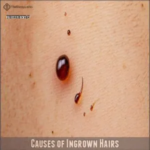 Causes of Ingrown Hairs