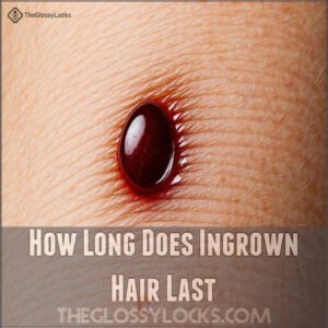 How Long Does Ingrown Hair Last