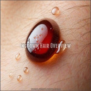 Ingrown Hair Overview