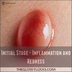 Initial Stage - Inflammation and Redness