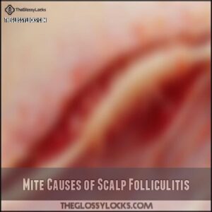 Mite Causes of Scalp Folliculitis