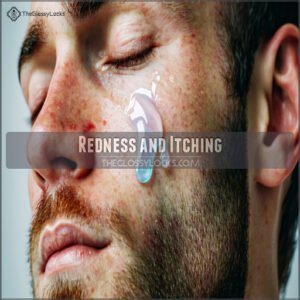 Redness and Itching