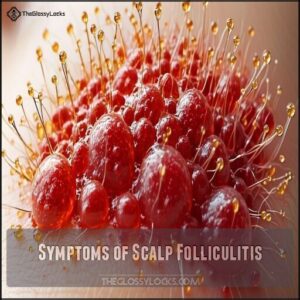 Symptoms of Scalp Folliculitis