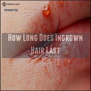 How Long Does Ingrown Hair Last