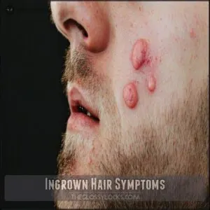 Ingrown Hair Symptoms