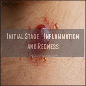 Initial Stage - Inflammation and Redness