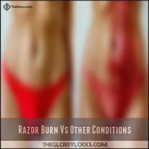 Razor Burn Vs Other Conditions Razor Burn Vs Other Conditions