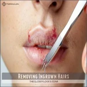 Removing Ingrown Hairs Removing Ingrown Hairs
