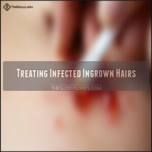 Treating Infected Ingrown Hairs