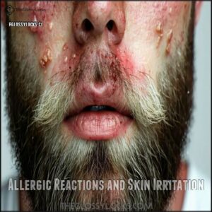 Allergic Reactions and Skin Irritation Allergic Reactions and Skin Irritation