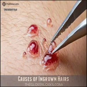 Causes of Ingrown Hairs
